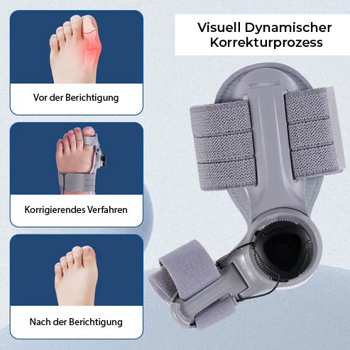Flexibler Hallux Valgus-Korrektor für Zeigenausrichtung und Komfort